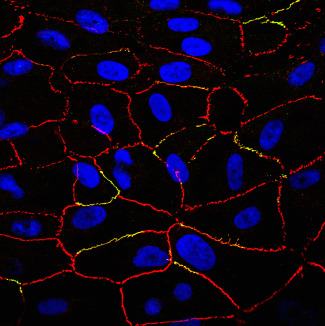 Hiperglicèmia i l'epiteli pigmentari de la retina