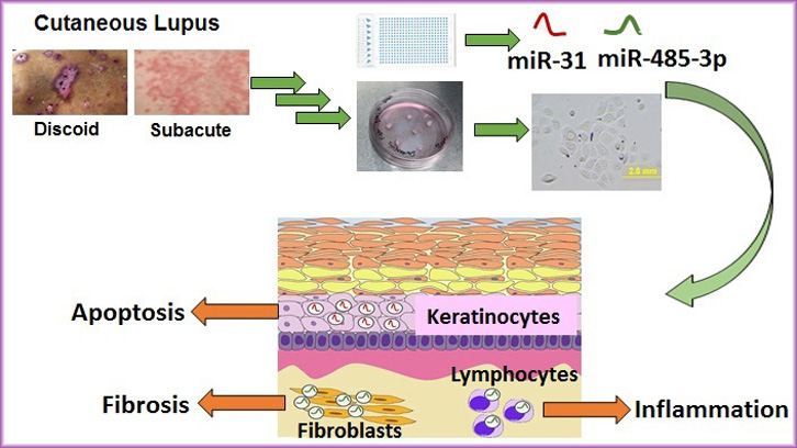 lupus microRNA