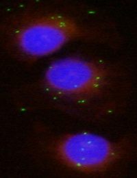 Interacció d'H.parasuis