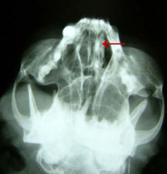 Dent incrustat a les fosses respiratòries d'un gat
