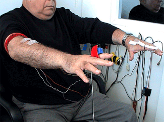 L'amantadina, ineficaç contra el tremolor essencial