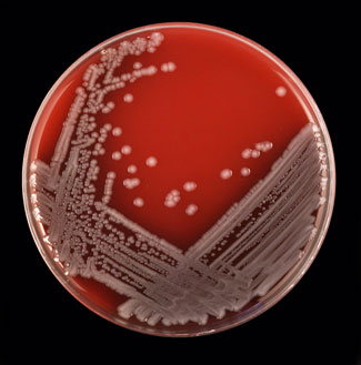 E. coli creixent en agar