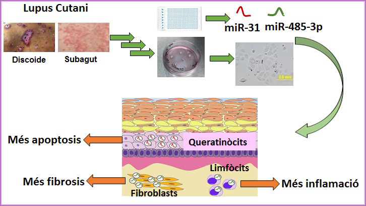 lupus microRNA