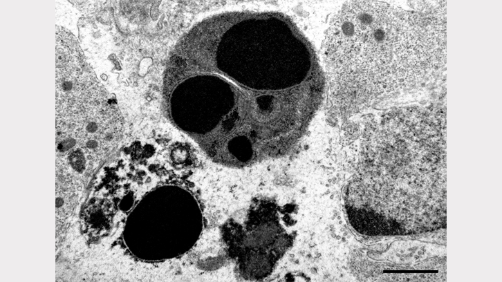 farmac hidroxiurea en dones embarassades