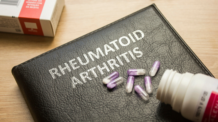 imatge representant artritis