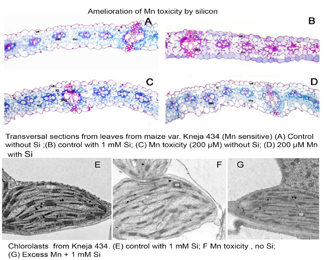 Toxicitat per manganès