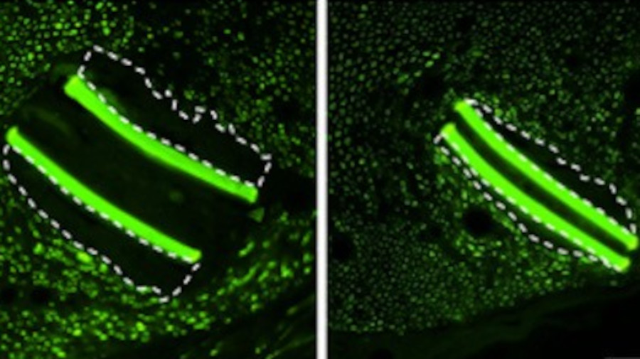 A la izquierda, implante sin dexametasona; a la derecha, con tratamiento. 