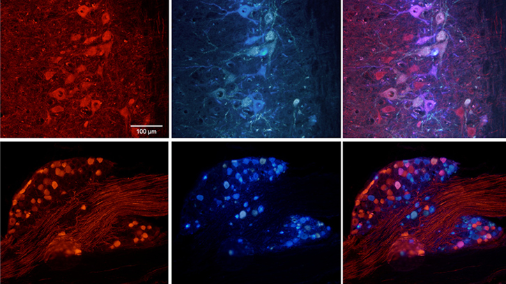 imatges al microscopi de les neurones de ratolí