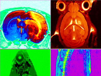 Ressonància magnètica