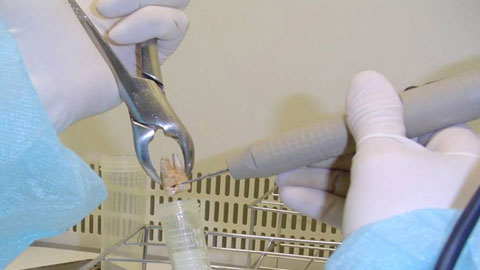 Obtenen per primer cop material genètic antic del bacteri de la càries