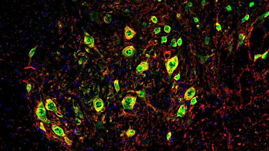 Motoneurones de la medul·la espinal de ratolí