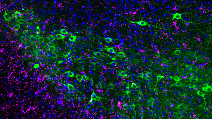 En verd, neurones dopaminèrgiques de ratolí (substància nigra). En magenta, microglia