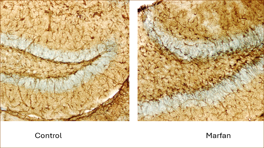 Imatge de microscopia d'astròcits a l¿hipocamp de ratolins mascle