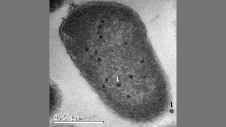 imatge de micrografia